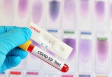 Στο ΠΕΔΥ (παλαιό Νοσοκομείο) θα διενεργούνται τα δωρεάν rapid test στον Δ.Σερρών Στο Παλαιό Νοσοκομείο θα διενεργούνται τα δωρεάν serrespost.gr Διεξαγωγή δωρεάν rapid test στην serrespost.gr Το εβδομαδιαίο πρόγραμμα δωρεάν μαζικών δειγματοληψιών serrespost.gr Καστανούσα Βαμβακοφύτου rapid tests Τρίτη 13 Απριλίου δωρεάν rapid test Δήμος Σιντικής Δωρεάν