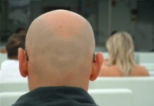 Τέλος η φαλάκρα; Το νέο προϊόν από την Κίνα που υπόσχεται επανεμφάνιση μαλλιών μέσα σε λίγες εβδομάδες falakros